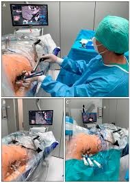 3D planning and ablation targeting